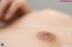 A close up of a woman's breast with a bruise on it.